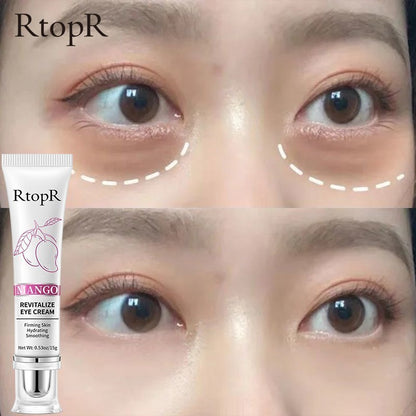 Eye Cream RtopR Mango Anti-Wrinkle Moisturizing Anti-Age Remove Dark Circles Eye Care Against Puffiness And Bags Hydrate Cream