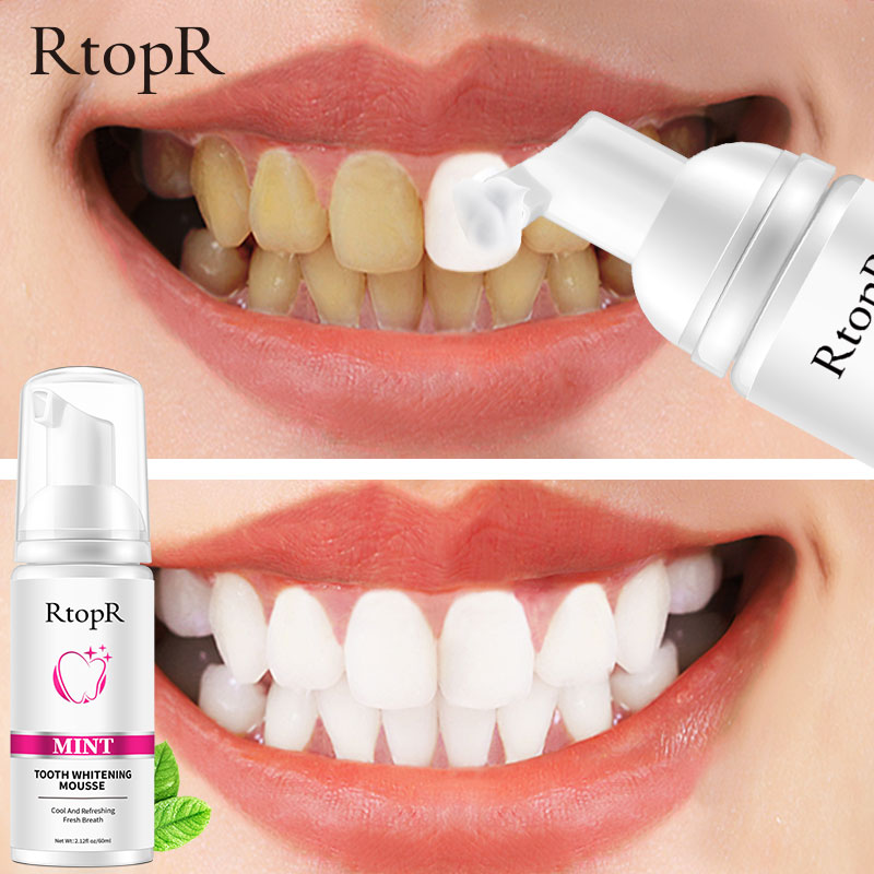 RtopR Teeth Cleansing Whitening Mousse Removes Stains Teeth Whitening Oral Hygiene Mousse Toothpaste Whitening and Staining 60ml
