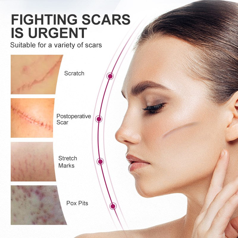 Fade Scar Stretch Marks Remover Cream Skin Repair Face Cream Acne Spots Acne Treatment Blackhead Whitening Cream Skin Care